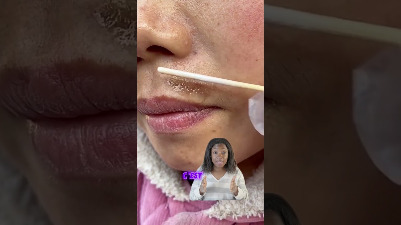 Produit miracle contre les taches pigmentaires ? #hyperpigmentation