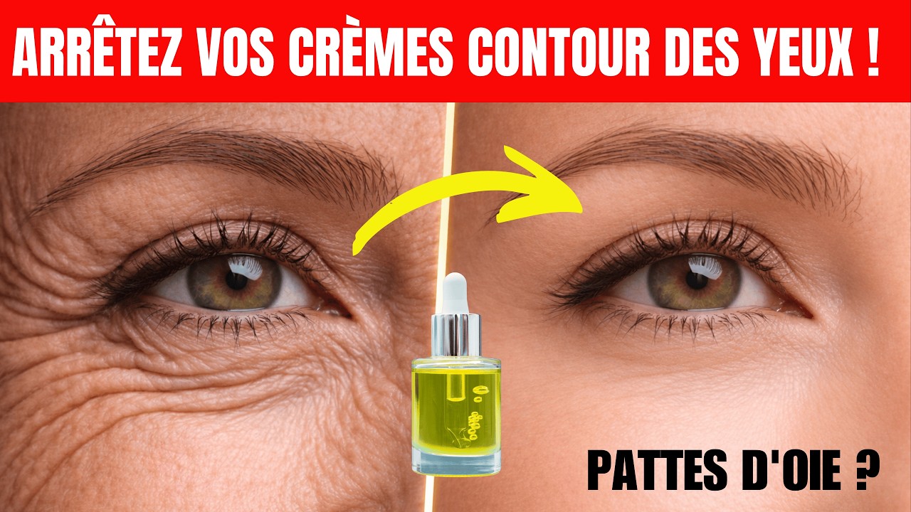 Dermatologue Révèle : Appliquez CECI Chaque Soir… les Pattes d'Oie Disparaissent en 17 Jours !