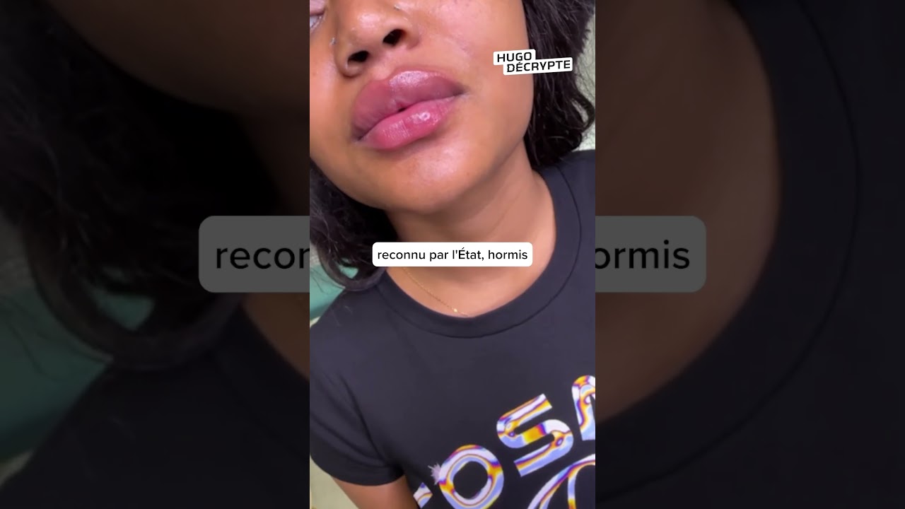 2 soeurs ont injecté illégalement de botox à 600 clientes