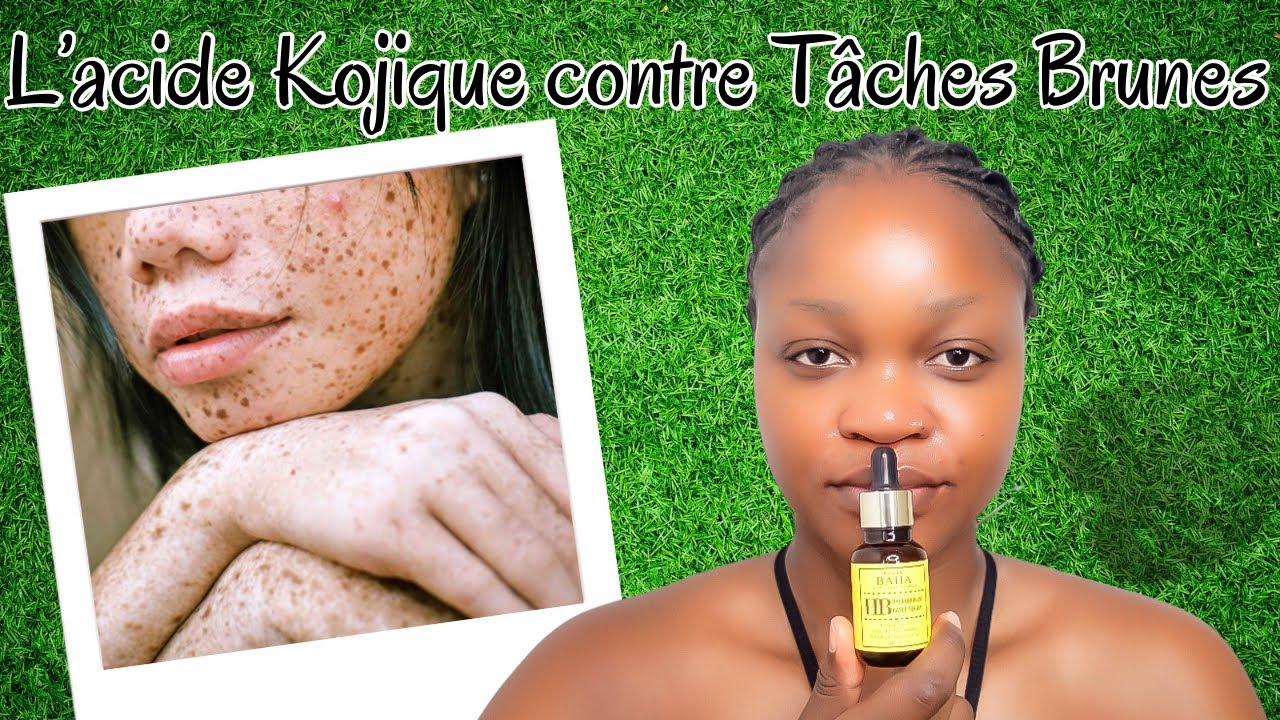 L’acide kojique contre les Taches brunes: comment j’utilise dans ma routine || Sérum COS DE BAHA