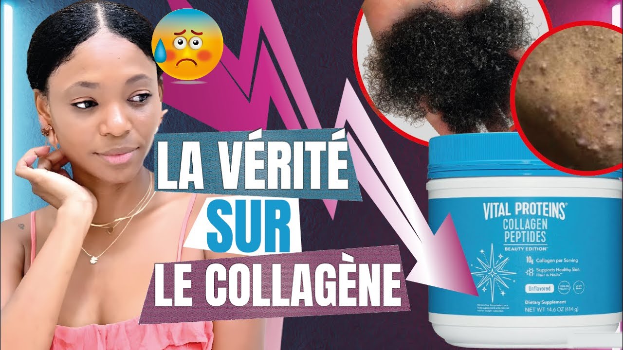 J'ai pris du collagène et voilà ce qu'il m'est arriver ... :/