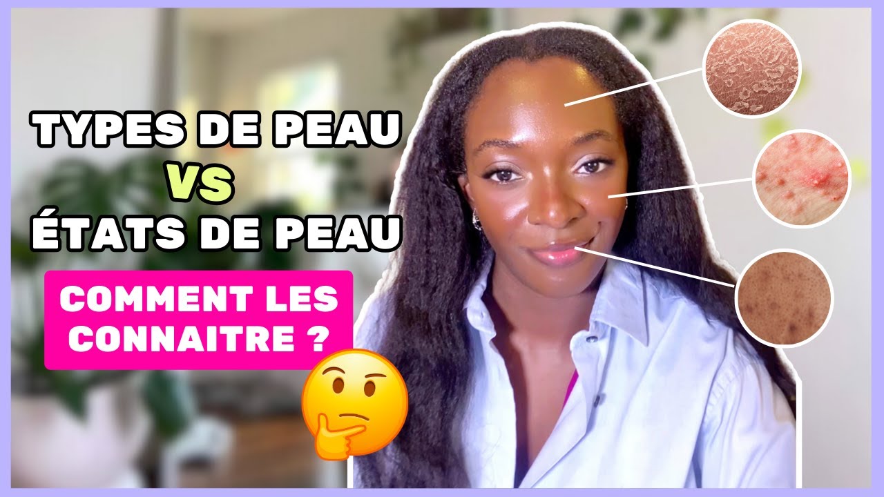 COMMENT CONNAITRE SON TYPE DE PEAU ET SON ÉTAT DE PEAU ? | Normale, Grasse, Mixte, Sèche, Sensible ?