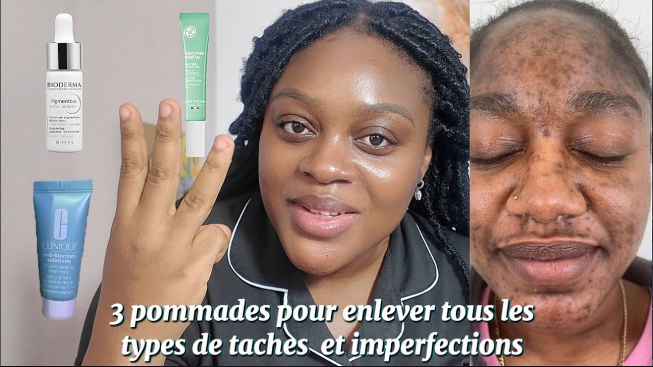 Comment enlever toutes les taches de son corps à jamais | Angele De Gides @YvesRocherFr @biodermamx