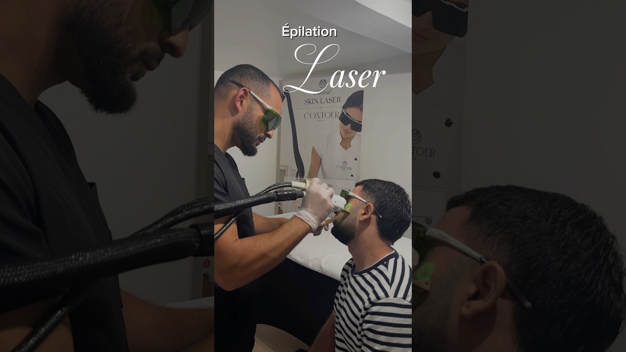 Épilation laser définitive du contour de la barbe et du cou à Rouen #épilation #laser