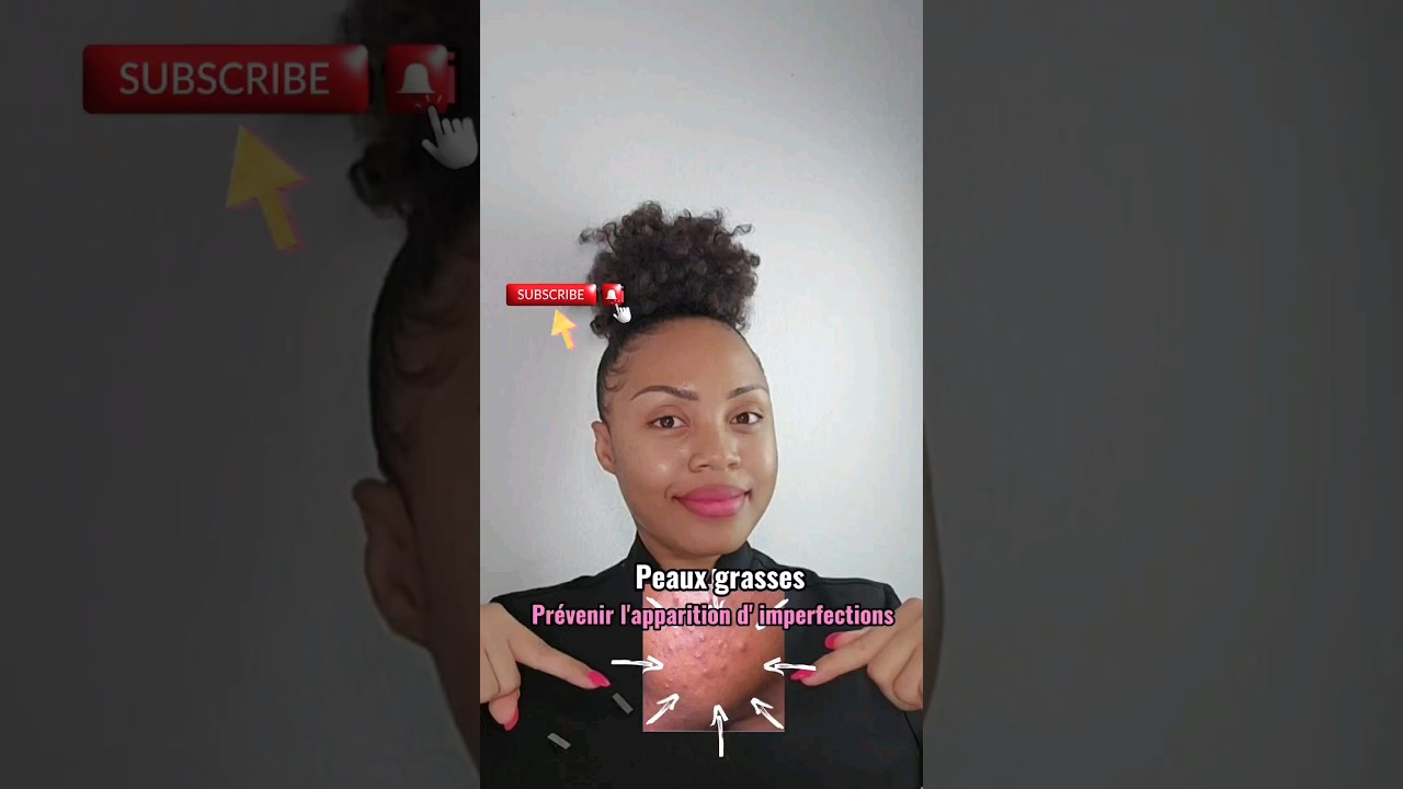 Choses à savoir absolument Quand on a la peau grasse 🔛