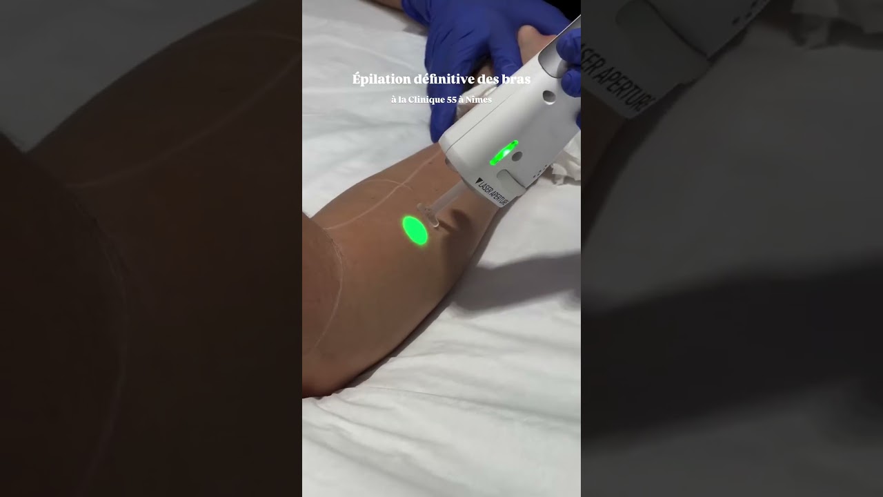 Une séance d'épilation définitive à la clinique55!#nimes #epilationdefinitive #laser